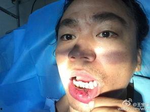 缝嘴巴的图片,创意无限的艺术之旅